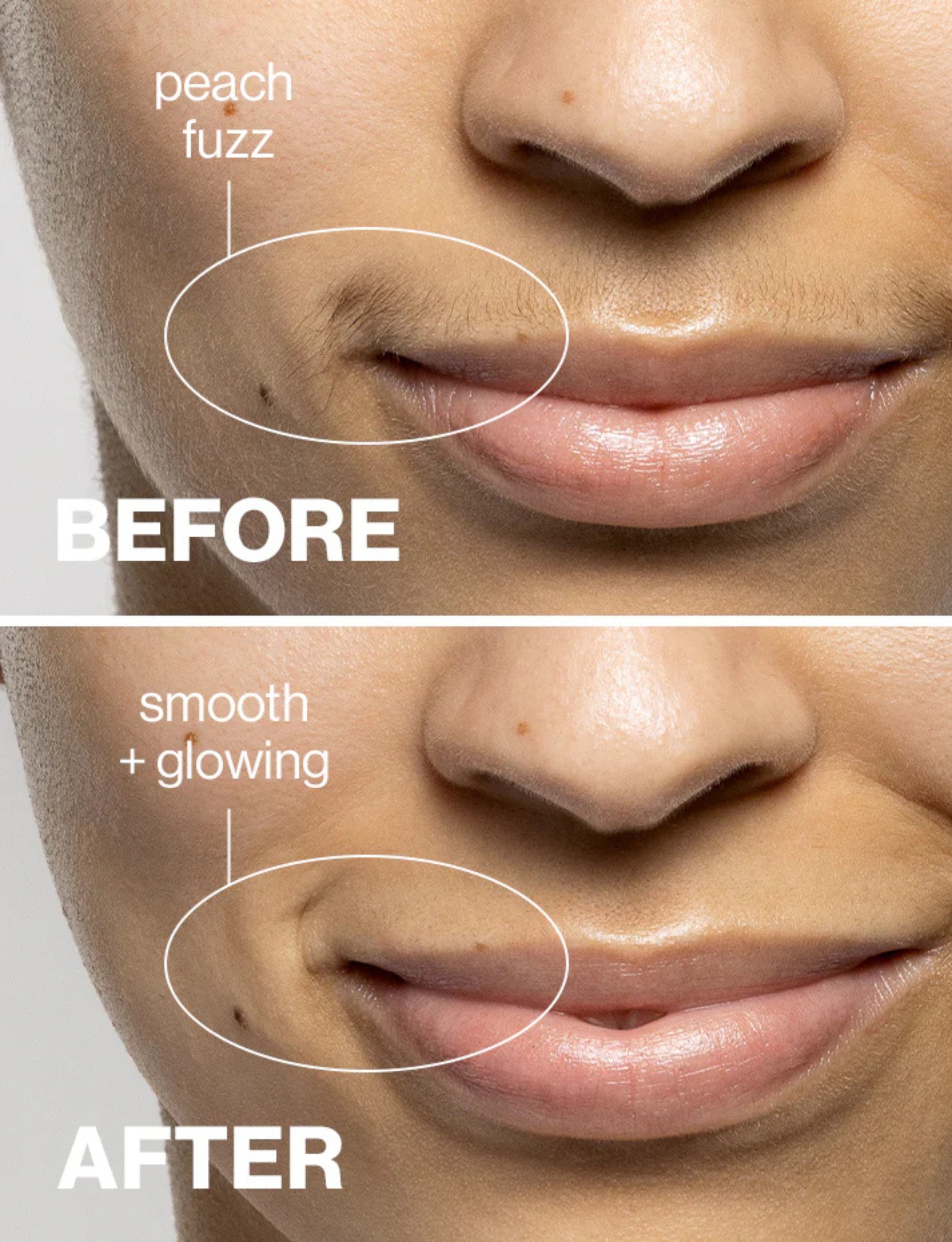 Silkee SonicSmooth Pro+