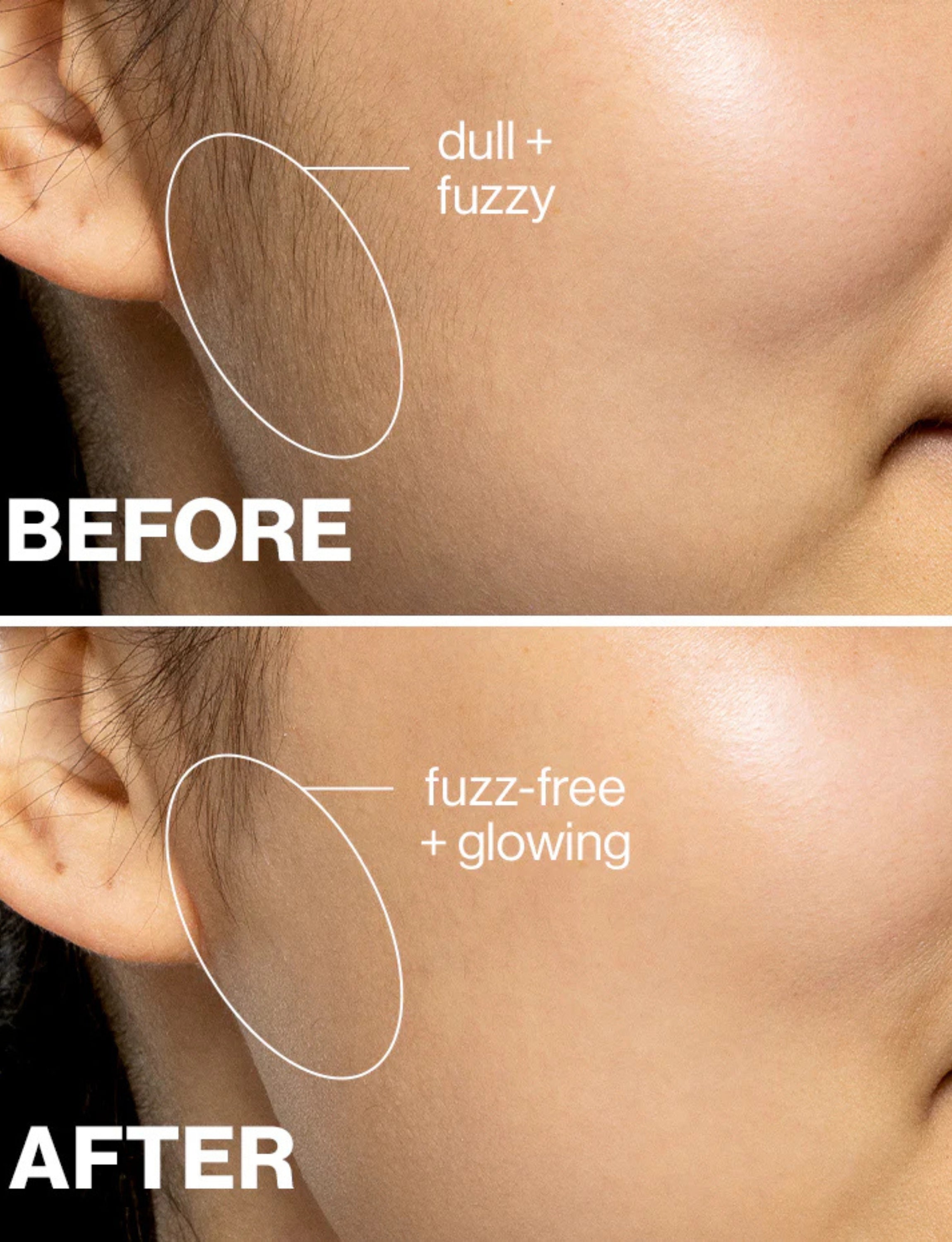 Silkee SonicSmooth Pro+