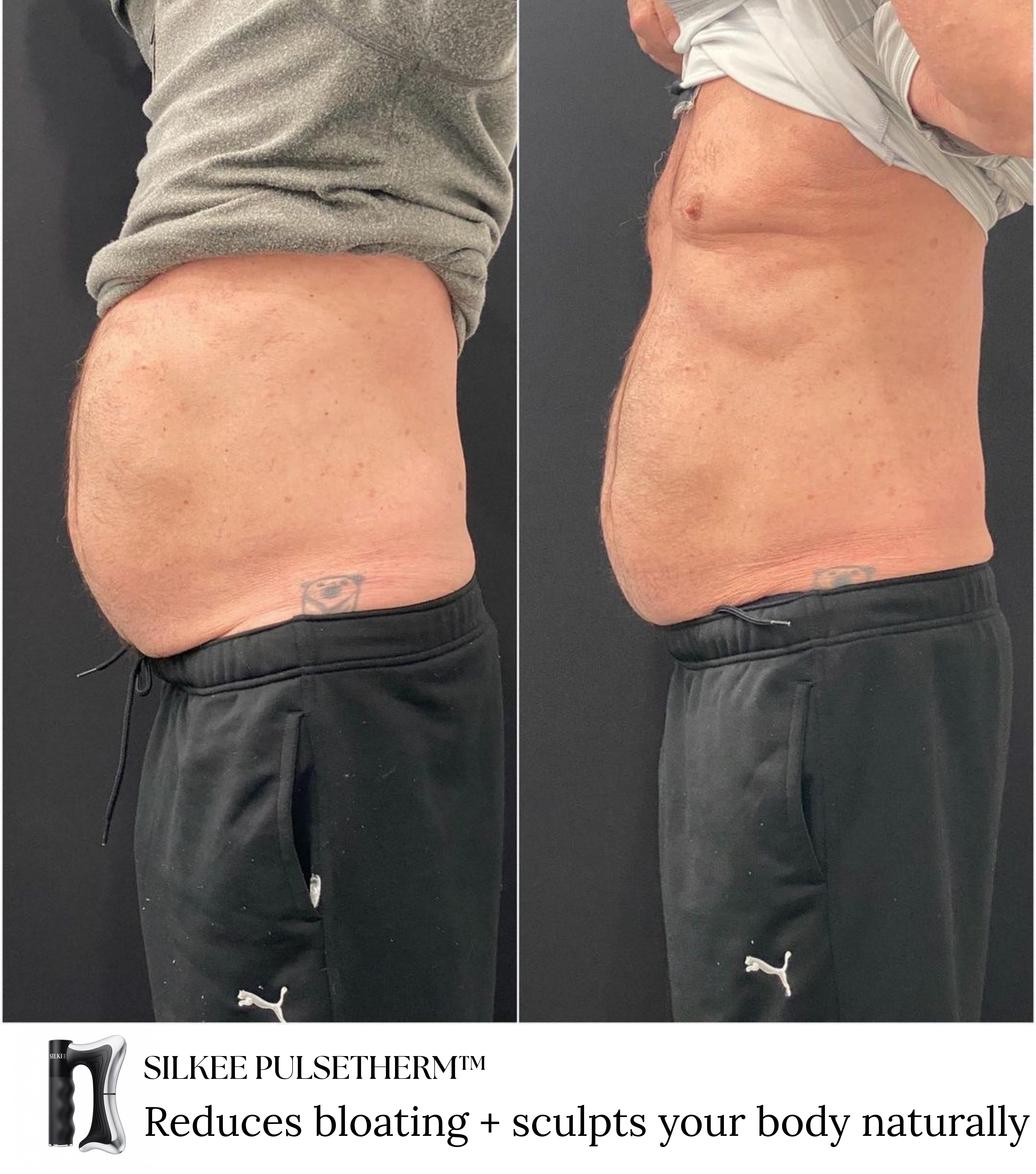 Silkee PulseTherm