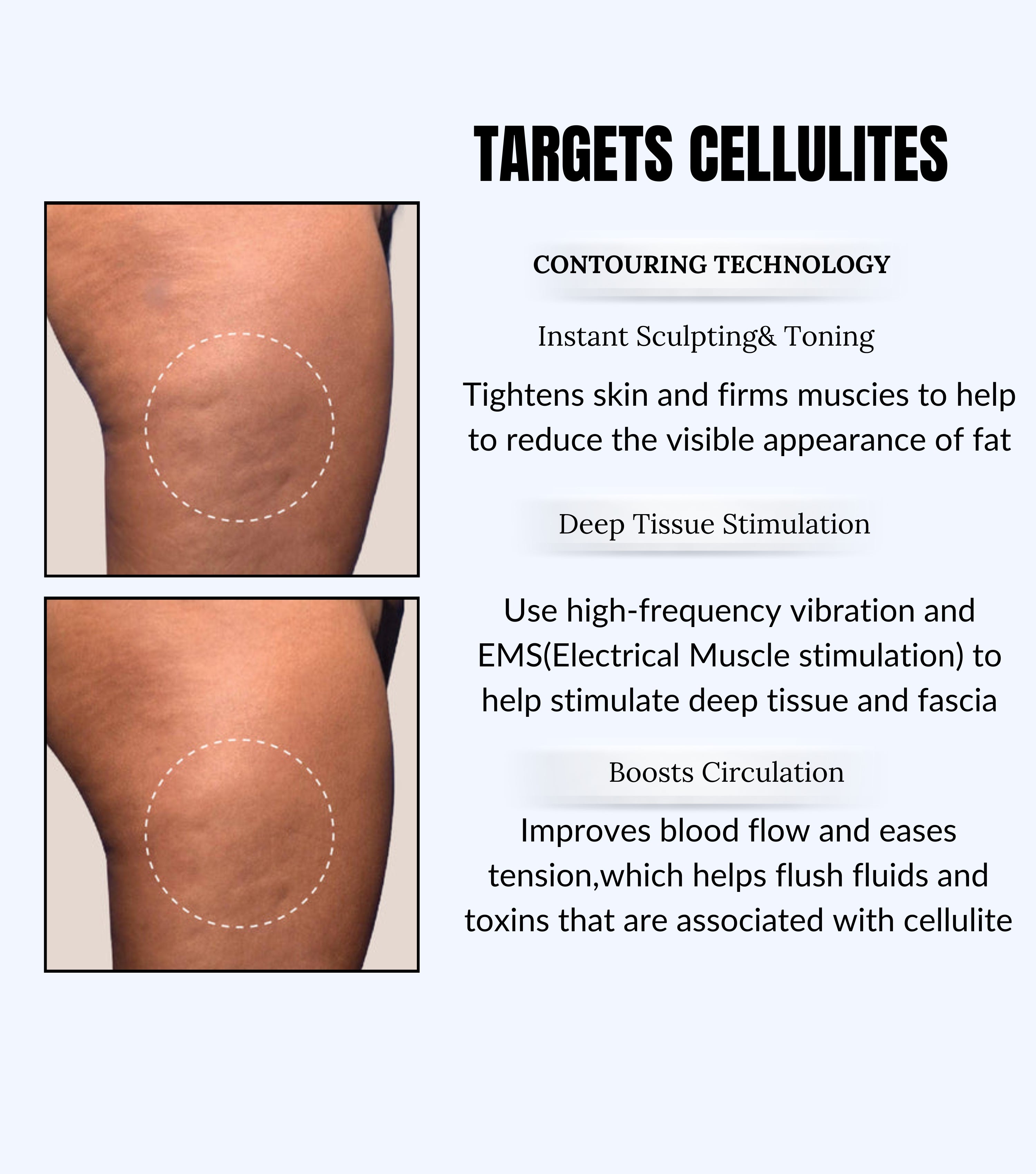 Silkee Thermal EMS Massager